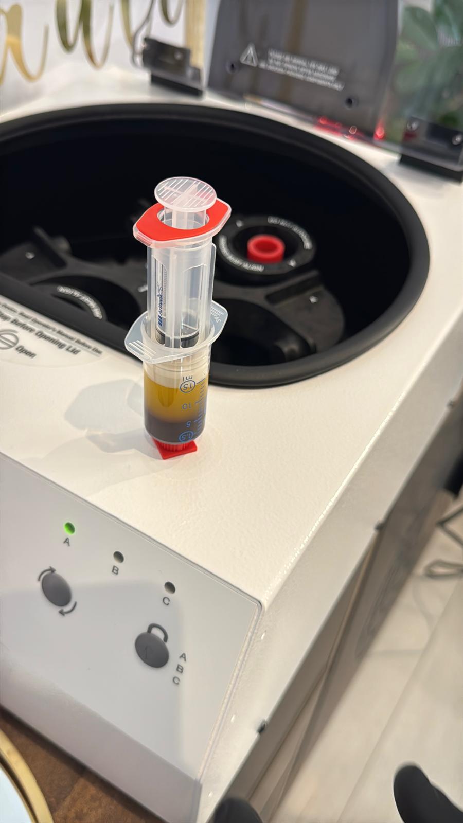 PRP treatments